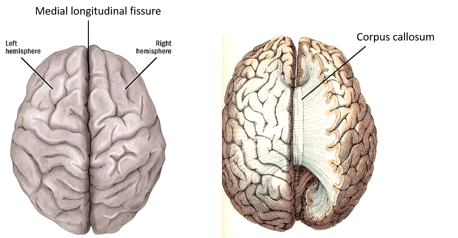 Полушария большого мозга соединены. Полушария мозга и мозолистое тело. Анатомия мозга человека мозолистое тело. Латерализация полушарий мозга. Латерализация коры мозга.